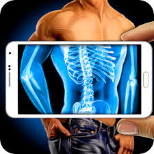 Philips respironics issued a recall fo. Scanner X Ray Full Body Joke Apk Download Free Game For Android Safe
