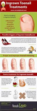 Pin On Health Infographics