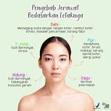 Proses mengeluarkan jerawat di muka. Setiap Jerawat Di Muka Kita Punya Arti Lo Emang Iya Coba Kita Lihat Apa Aja Si Penyebab Jerawat Kalau Dilihat Dari Jerawat Perawatan Kulit Produk Jerawat