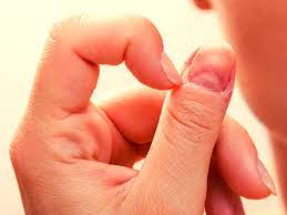 The strongest risk factor for developing skin cancer is ultraviolet (uv) ray exposure, typically from the sun. If You Have This Mark On Your Nail Get Tested For Skin Cancer Times Of India