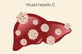 Hepatita C Tot Ce Trebuie Sa Stii Reginamaria Ro