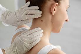 5 Reasons It's Important to See Your Dermatologist for Regular Skin Checks  | Moy Fincher Chipps