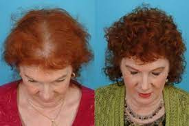 Fifty is the average age for menopause, but changes to your hair can begin before, and sometimes after 50, there is no rule but your mother's pattern is a good guide of when and what. Menopause Taboos Thinning Hair Painful Sex And What You Can Do