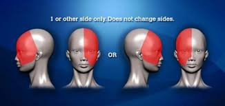 Image result for Acute Localized Headache