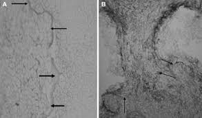 Image result for Uapaca sansibarica