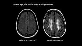 Image result