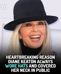 There's a heartbreaking reason behind the fashion choice 💔