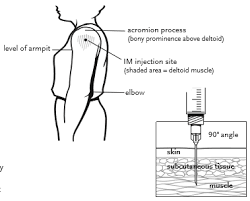 Check spelling or type a new query. Https Cpe Pharmacy Ufl Edu Wordpress Files 2021 03 Assessorinstructionsforinjectiontechniqueassessment Pdf