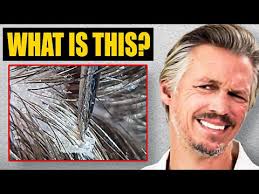 William Gaunitz Trichologist