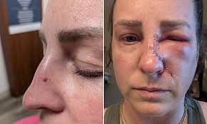 How many more children have to die before people take food allergies  seriously?': Parents of tragic Pret baguette teen Natasha Ednan-Laperouse  speak out at inquest of schoolgirl, 13, who suffered a fatal