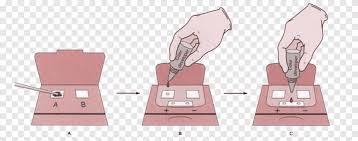 We did not find results for: Fecal Occult Blood Stool Guaiac Test Stool Test Blood Test Blood Hand Medicine Png Pngegg
