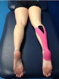 Image result for Taping for Soleus and Achilles