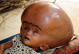 3 Fruits A Eviter Pendant La Grossesse Qui Peuvent Deformer Votre Bebe Africa24 Info