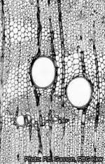 Image result for Brachystegia spiciformis × microphylla