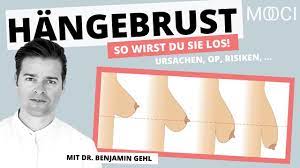 Januar 2007 um 20:21 letzte antwort: Hangebruste Tipps Behandlung Kosten Mooci