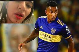 Sebastián villa cano (born 19 may 1996) is a colombian professional footballer who plays for boca juniors. Sebastian Villa Accused Of Hitting His Girlfriend Who Showed Wounds World Today News