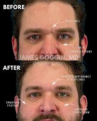 James D. Goggin M.D. (@drjamesgoggin) • Instagram photos and videos