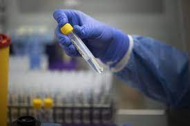 Rki und lgl melden die neuesten fallzahlen zu neuinfektionen, inzidenz und co. Corona In Nrw Die 7 Tage Inzidenz Fur Wuppertal Krefeld Und Dusseldorf