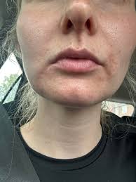 I think my cuticles are dilated...