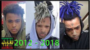 Evolution of XXXtentacion Dreads 2012 - 2018 - YouTube