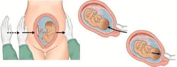 Uterine contractions felt during bimanual examination. Diagnosis Of Pregnancy In Three Trimesters Vaidyaà¤¨à¤®