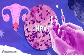 Image result for human papillomavirus symptoms