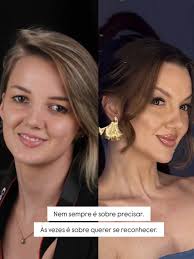 Harmonização facial não transforma… ELA VALORIZA! ✨ 🔺De acordo com as  resoluções 196/2019 e federal 5081/66. 🔺As imagens foram autorizadas pelo  paciente, e ilustram um caso específico, cada paciente tem suas  características