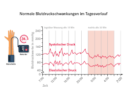 Wenn man ab welchen blutdruckwerten spricht man von hypertonie? Bluthochdruck Pascoe Naturmedizin