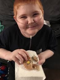 Teen recovering from double lung transplant