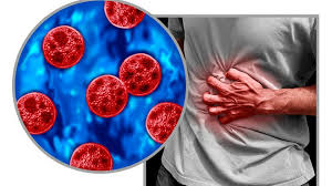 Cyclosporisis cases climb in Pittsburgh as outbreak surges around US
