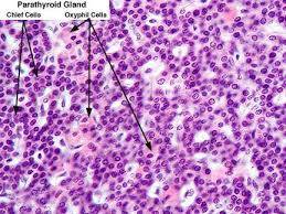 Parathyroid Gland Medical Laboratory Science Physiology Anatomy And Physiology