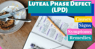Luteal Phase Defect Lpd Causes Signs Symptoms And Remedies