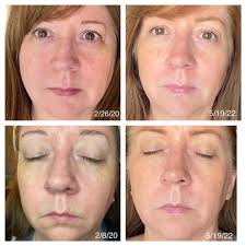 What a difference a haircut makes