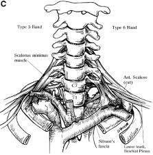 Sibson fascia information including symptoms, causes, diseases, symptoms, treatments, and other medical and health issues. Etiology Of Neurogenic Thoracic Outlet Syndrome Hand Clinics