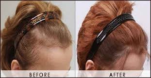 Jojoba oil is the golden ticket to hair care. Jojoba Oil For The Hair Benefits And How To Use