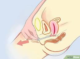 إخراج واقي جنسي عالق بداخلك Wikihow