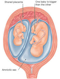 Check spelling or type a new query. You Are 10 Weeks And 2 Days Pregnant Familyeducation