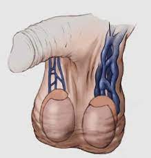 اعتاد وحدة مكعب علاج دوالي الخصيتين عند الرجال dsvdedommel com