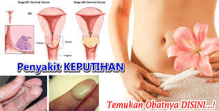 Terjadi pendarahan abnormal pada rahim. Obat Herbal Wanita3 Kenapa Keputihan Berwarna Coklat Bercampur Darah Sangat Bau