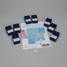 Describe what you might see if you were to look at cells through a microscope. Typical Animal And Plant Cells Microscope Slide Classroom Set Walmart Com Walmart Com