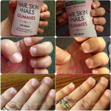 Maybe you would like to learn more about one of these? Hair Skin Nails Vitamin Review