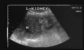 Pin On Abd 200 Mod 3 Ultrasound