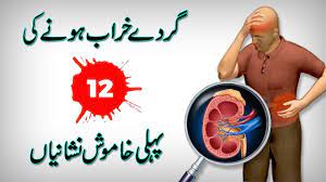 Problem in urdu has be en presented. Symptoms And Causes Of Thyroid Diseases Thyroid Gland Function In Urdu Hindi Youtube