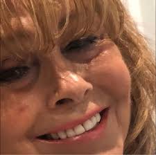 My first ever job leaving school at 15 was in the pressure dyecasting shop 