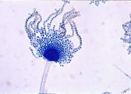 Several mechanisms could explain this difference, although the combination of segmental duplication, genome duplication, and horizontal gene transfer acting in a piecemeal fashion is. Aspergillus Flavus Aspergillus Aspergillosis Website
