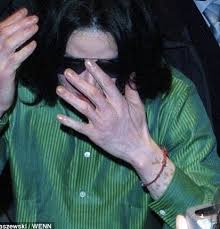 Why Did Michael Jackson S Skin Turn White Quora Michael Jackson Photoshoot Michael Jackson Smile Vitiligo Michael Jackson
