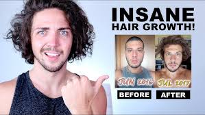 HAIR GROWTH TIME LAPSE