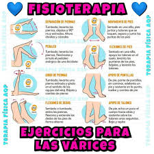 Patrick Fisio Home Fisioterapia Ejercicios Varices Cr Imagen Facebook
