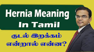 Hernia Meaning In Tamil க டல இறக கம என ற ல என ன Best Laparoscopic Surgical Center Coimbatore Chen Youtube