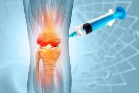 Image result for Knee Joint Injection